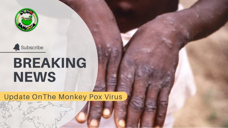 Jamaica's First Monkey Pox patient